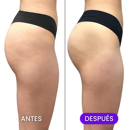 Gominola Glutea+ Levantado y Definición Glúteos