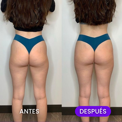 Gominola Glutea+ Levantado y Definición Glúteos